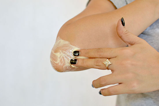 تیرگی آرنج و زانو