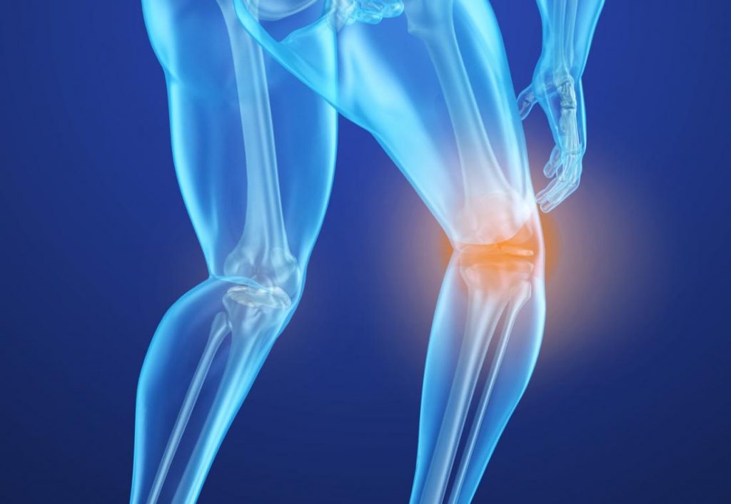 درمان پوکی استخوان با روش‌های طب سنتی