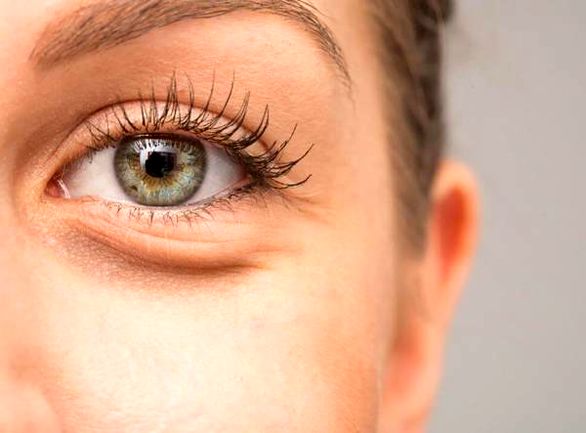 درمان پف زیر چشم با روش‌های طب سنتی