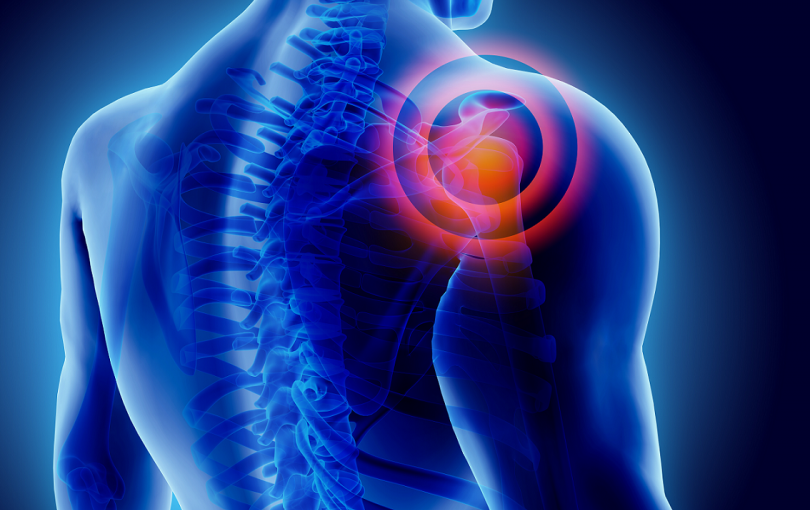 رفع درد شانه با روش‌های طب سنتی