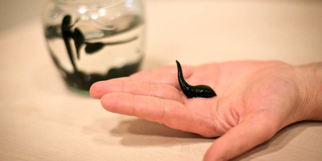 فواید زالو درمانی