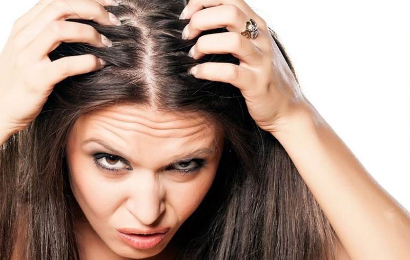 درمان خشکی پوست سر